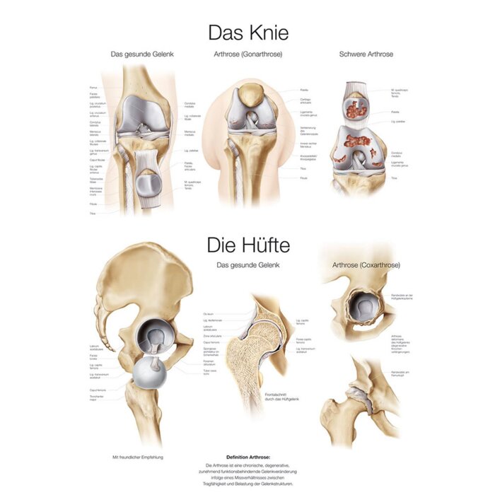 Erler-Zimmer Anatomische Lehrtafel "Das Knie / Die Hüfte"