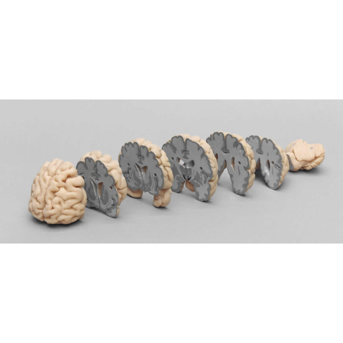 Erler-Zimmer Menschliches Gehirn Modell in Frontalschnitten
