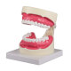 Erler-Zimmer Zahnpflegemodell 15 fache Größe