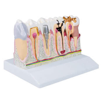 Erler-Zimmer Dentalmodell 4 fache Größe