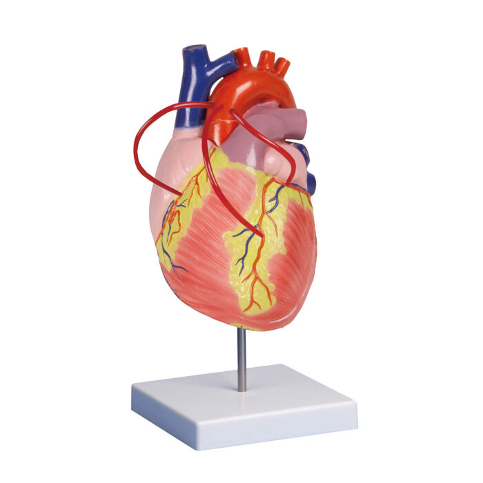 Erler-Zimmer Herz Modell mit Bypass 2 fache Lebensgröße 2 Teile