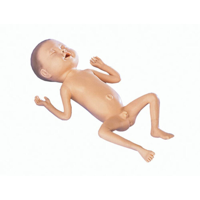 Erler-Zimmer Fr&uuml;hgeborenen Modell 24 Wochen alt