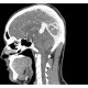 Erler-Zimmer Kopf und Hals Phantom für CT, Röntgen und Strahlentherapie