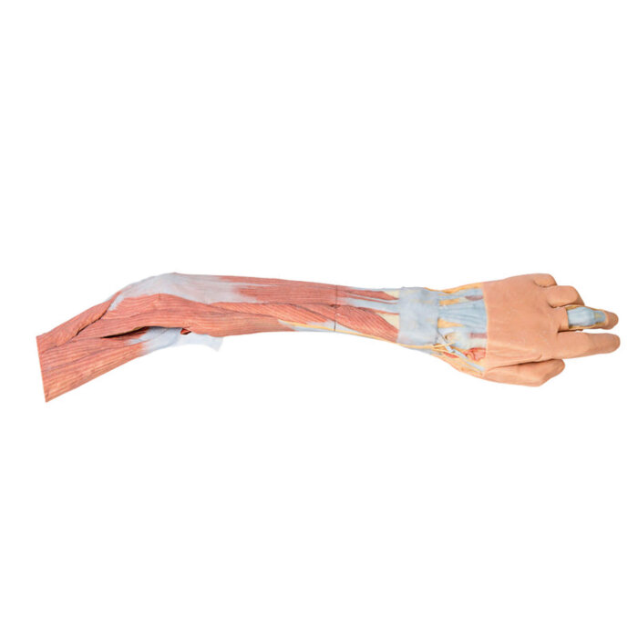 Erler-Zimmer Obere Extremität – Ellenbogen, Unterarm und Hand