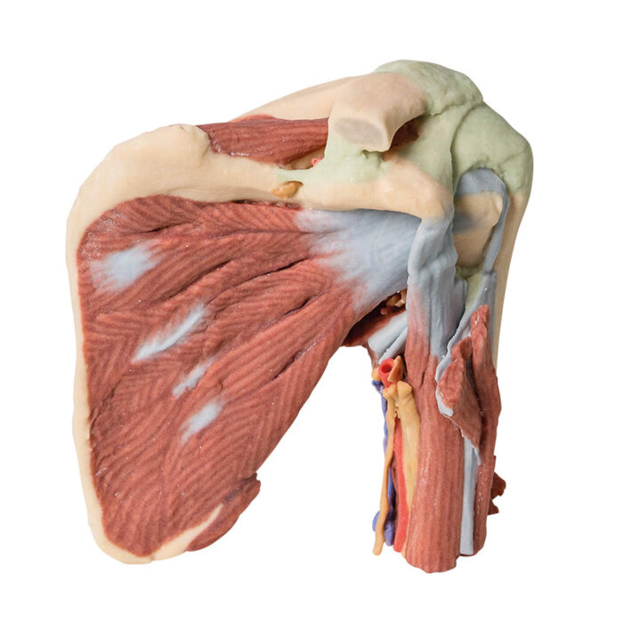 Erler-Zimmer Schulter – tiefe Präparation des linken Schultergelenks, der Muskulatur sowie der dazugeh. Nerven
