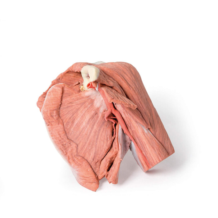 Erler-Zimmer Schulter (links) – Oberflächliche Muskeln mit Arteria axillaris/brachialis